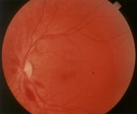 linkes Auge 9. September